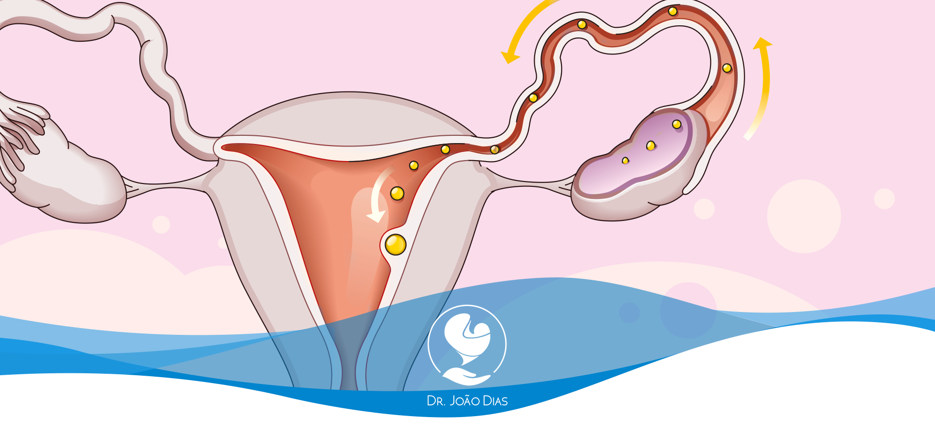 Menstruação com cheiro NÃO É NORMAL! Procure seu médico!! Tem mais alg