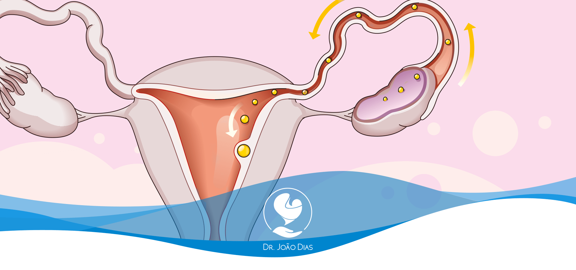 Nidação: o que isso significa e como pode dar errado? » Dr João Dias